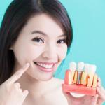 tooth implant oral surgery los angeles