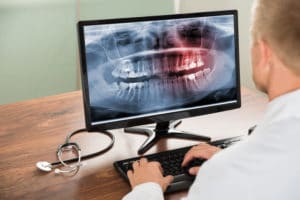 Doctor Looking At Teeth X-ray On Computer