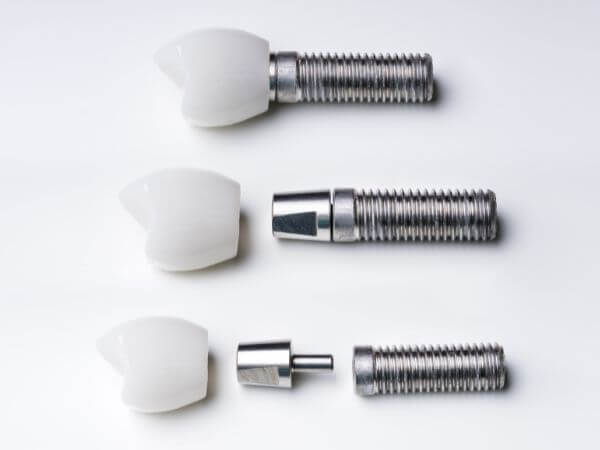 stage-three-dental-implants
